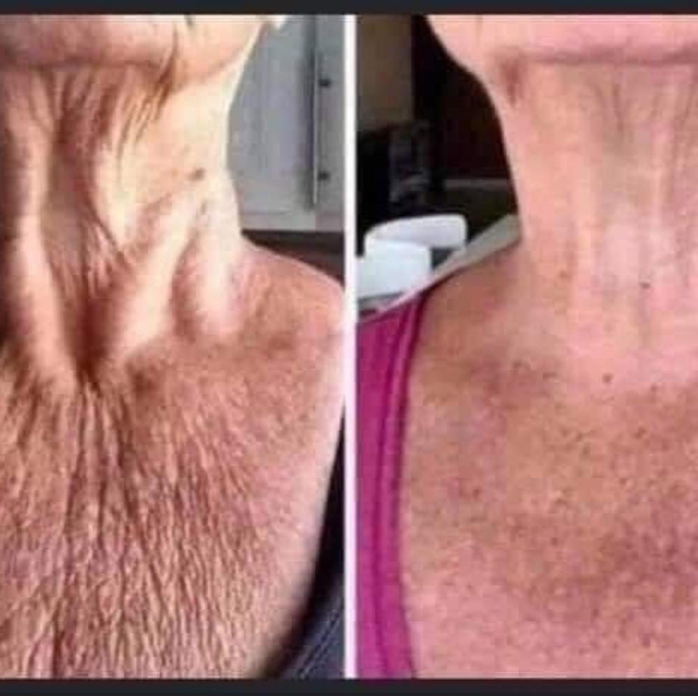 Firming/Contouring/cellulite reducer cream